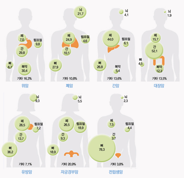 암 장기별 전이율
